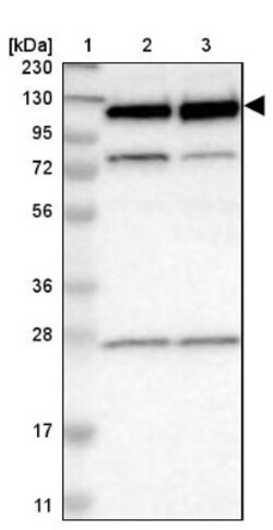 RBM5 Antibody, Novus Biologicals 25 &mu;L | Buy Online | Novus Biologicals | Fisher Scientific