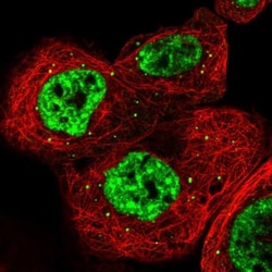 RBM6 Antibody, Novus Biologicals 0.1mL; Unlabeled:Antibodies, Polyclonal