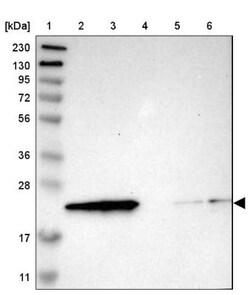 RBM8A Antibody, Novus Biologicals 0.1mL; Unlabeled:Antibodies, Polyclonal