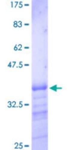 Novus Biologicals Recombinant Human RBMS1 GST (N-Term) Protein 10 &mu;g | Buy Online | Novus Biologicals&trade; | Fisher Scientific