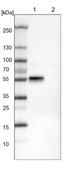 RBMS3 Antibody, Novus Biologicals 25 &mu;L; Unlabeled:Antibodies, Polyclonal