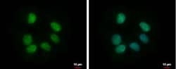 RBMY1F Antibody, Novus Biologicals 0.1mL; Unlabeled:Antibodies, Polyclonal