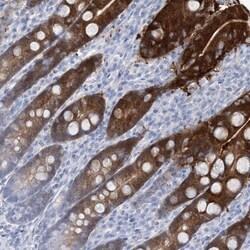RBP2 Antibody, Novus Biologicals 0.1mL; Unlabeled:Antibodies, Polyclonal