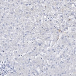 RBP2 Antibody, Novus Biologicals 0.1mL; Unlabeled:Antibodies, Polyclonal