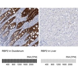 RBP2 Antibody, Novus Biologicals 0.1mL; Unlabeled:Antibodies, Polyclonal