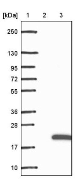 RBP2 Antibody, Novus Biologicals 0.1mL; Unlabeled:Antibodies, Polyclonal