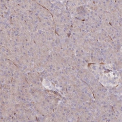 RBP5 Antibody, Novus Biologicals:Antibodies:Primary Antibodies
