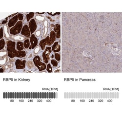 RBP5 Antibody, Novus Biologicals:Antibodies:Primary Antibodies