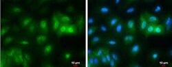 RBPMS Antibody, Novus Biologicals 0.1mL; Unlabeled:Antibodies