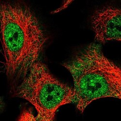 anti-RBPMS, Polyclonal, Novus Biologicals 0.1 mL | Buy Online | Novus Biologicals | Fisher Scientific