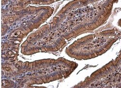 RBPMS Antibody, Novus Biologicals 0.1mL; Unlabeled:Antibodies