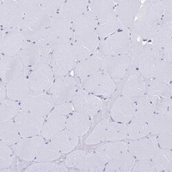 anti-RBPMS, Polyclonal, Novus Biologicals 0.1 mL | Buy Online | Novus Biologicals | Fisher Scientific