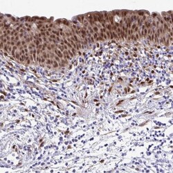 anti-RBPMS, Polyclonal, Novus Biologicals 0.1 mL | Buy Online | Novus Biologicals | Fisher Scientific