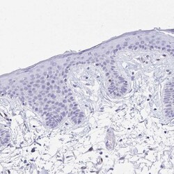 anti-RBPMS, Polyclonal, Novus Biologicals 0.1 mL | Buy Online | Novus Biologicals | Fisher Scientific