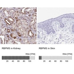 anti-RBPMS, Polyclonal, Novus Biologicals 0.1 mL | Buy Online | Novus Biologicals | Fisher Scientific