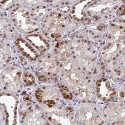 anti-RBPMS, Polyclonal, Novus Biologicals 0.1 mL | Buy Online | Novus Biologicals | Fisher Scientific