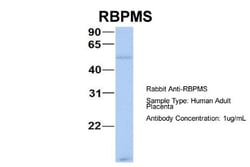 RBPMS Antibody, Novus Biologicals 100&mu;L; Unlabeled:Antibodies, Polyclonal