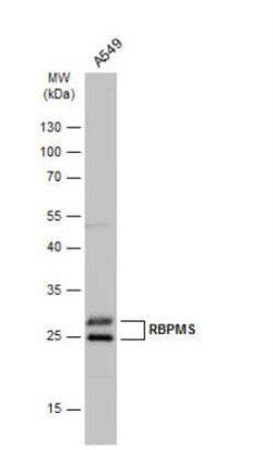RBPMS Antibody, Novus Biologicals 0.1mL; Unlabeled:Antibodies