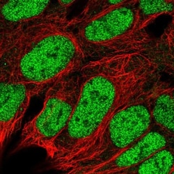 RBX1 Antibody, Novus Biologicals 0.1mL; Unlabeled:Antibodies, Polyclonal