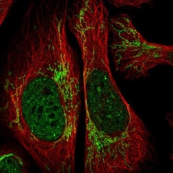 RCAN2 Antibody, Novus Biologicals 0.1mL; Unlabeled:Antibodies, Polyclonal