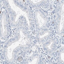 RCAN3 Antibody, Novus Biologicals 0.1mL; Unlabeled:Antibodies, Polyclonal
