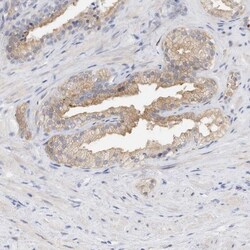 RCAN3 Antibody, Novus Biologicals 0.1mL; Unlabeled:Antibodies, Polyclonal