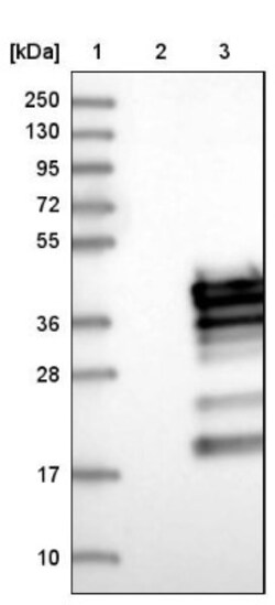 RCAN3 Antibody, Novus Biologicals 0.1mL; Unlabeled:Antibodies, Polyclonal