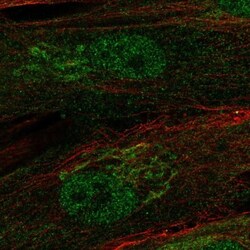 RCBTB2 Antibody, Novus Biologicals 0.1mL; Unlabeled:Antibodies, Polyclonal