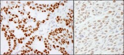 RCC2 Antibody, Novus Biologicals 0.1mL; Unlabeled:Antibodies, Polyclonal