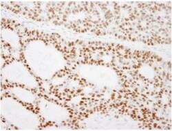 RCC2 Antibody, Novus Biologicals 0.1mL; Unlabeled:Antibodies, Polyclonal