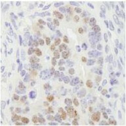 RCC2 Antibody, Novus Biologicals 0.1mL; Unlabeled:Antibodies, Polyclonal