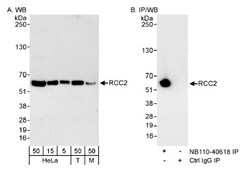 RCC2 Antibody, Novus Biologicals 0.1mL; Unlabeled:Antibodies, Polyclonal