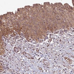 RCCD1 Antibody, Novus Biologicals 25 &mu;L, Unlabeled:Antibodies, Polyclonal