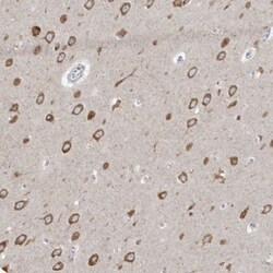 RCN2 Antibody, Novus Biologicals:Antibodies:Primary Antibodies