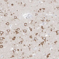 RCN2 Antibody, Novus Biologicals:Antibodies:Primary Antibodies