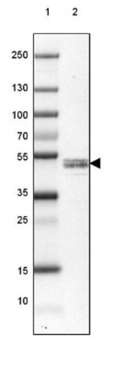 RCN2 Antibody, Novus Biologicals:Antibodies:Primary Antibodies