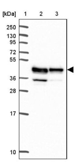 RCN3 Antibody, Novus Biologicals:Antibodies:Primary Antibodies