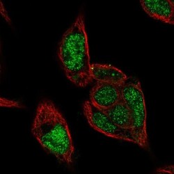 RCOR2 Antibody, Novus Biologicals 0.1mL; Unlabeled:Antibodies, Polyclonal
