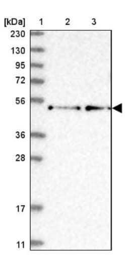 RCOR2 Antibody, Novus Biologicals 0.1mL; Unlabeled:Antibodies, Polyclonal