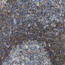 RCSD 1 Antibody, Novus Biologicals 25 &mu;L, Unlabeled:Antibodies, Polyclonal