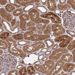 RDH14 Antibody, Novus Biologicals 0.1mL; Unlabeled:Antibodies, Polyclonal