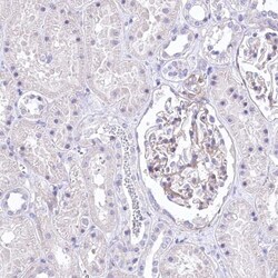 RDH16 Antibody, Novus Biologicals 0.1 mL | Buy Online | Novus Biologicals | Fisher Scientific