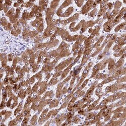 RDH16 Antibody, Novus Biologicals 0.1 mL | Buy Online | Novus Biologicals | Fisher Scientific