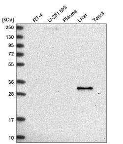 RDH16 Antibody, Novus Biologicals 0.1 mL | Buy Online | Novus Biologicals | Fisher Scientific