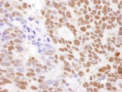 RECQ1 Antibody, Novus Biologicals 0.1mg; Unlabeled:Antibodies, Polyclonal