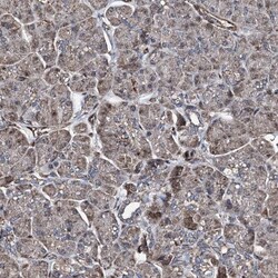 RECQ1 Antibody, Novus Biologicals 0.1mL; Unlabeled:Antibodies, Polyclonal