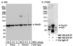 RECQ1 Antibody, Novus Biologicals 0.1mg; Unlabeled:Antibodies, Polyclonal
