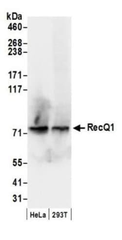 RECQ1 Antibody, Novus Biologicals 0.1mg; Unlabeled:Antibodies, Polyclonal