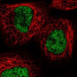 RECQL4 Antibody, Novus Biologicals:Antibodies:Primary Antibodies