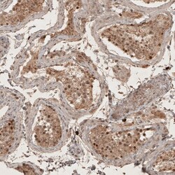 RECQL5 Antibody, Novus Biologicals 25 &mu;L | Buy Online | Novus Biologicals | Fisher Scientific